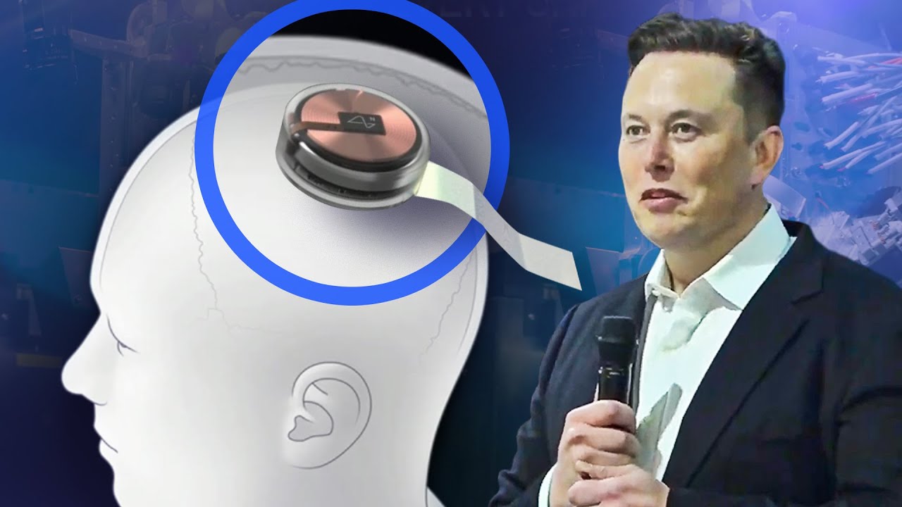 FDA grants approval for Elon Musk’s Neuralink to begin human testing of brain implants